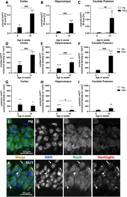 Quantification of Huntington’s Disease Related Markers in the R6/2 Mouse Model